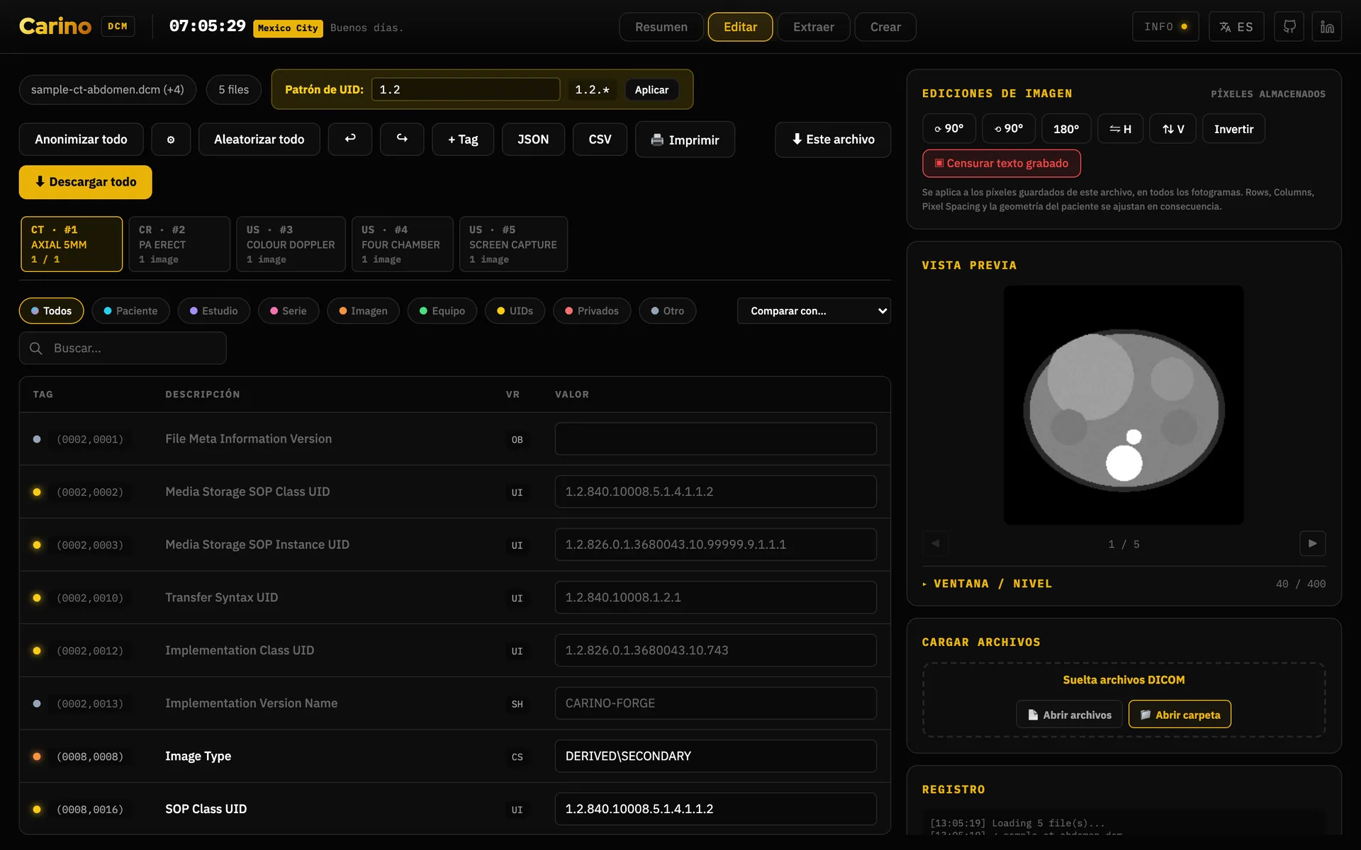 La pestaña de edición del editor: una barra con anonimizar todo, aleatorizar todo, añadir etiqueta, JSON, CSV, imprimir y descargar todo; una tira con las cinco series cargadas; filtros por paciente, estudio, serie, imagen, equipo, UIDs y etiquetas privadas; la tabla de etiquetas, una fila por atributo con su grupo y elemento, descripción, VR y un valor editable; y en el tercio derecho un panel de ediciones de imagen —girar, voltear, invertir y censurar el texto grabado, escrito en los píxeles guardados— sobre la vista previa, una lectura de ventana/nivel plegada y la zona para soltar archivos.