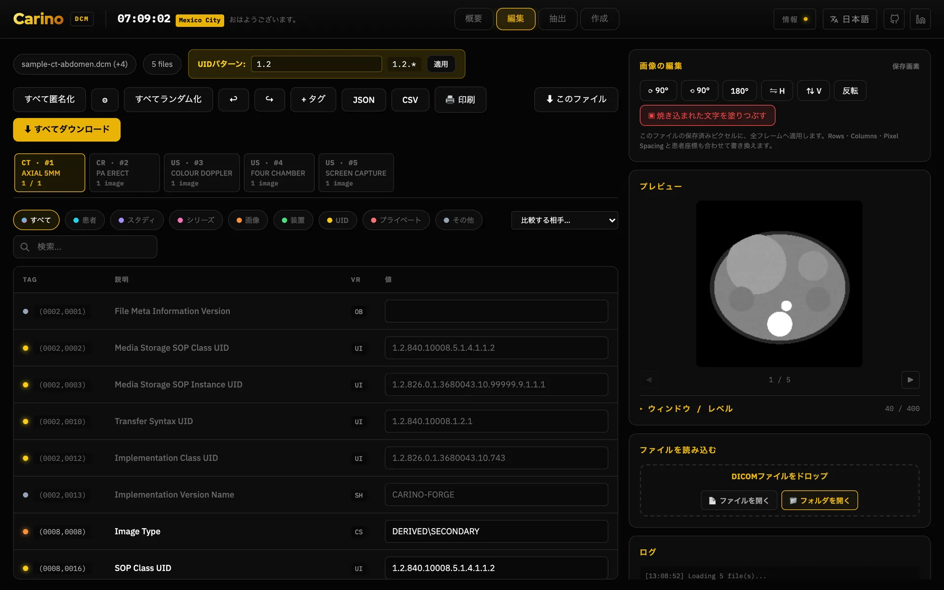 エディタの編集タブ。すべて匿名化、すべてランダム化、＋タグ、JSON、CSV、印刷、すべてダウンロードのツールバー、読み込んだシリーズの帯、患者・検査・シリーズ・画像・機器・UID・プライベートタグの絞り込みチップ、属性ごとに1行、グループ番号と要素番号、説明、VR、編集できる値が並ぶタグ表、そして右三分の一には画像編集パネル（回転・反転・階調反転・焼き込まれた文字の塗りつぶし。いずれも保存画素に書き込まれます）と、その下にプレビュー、折りたたまれたウィンドウ／レベルの値、ファイルのドロップ領域があります。